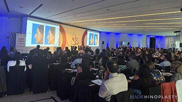El mejor curso de rinoplastia celebrado en España